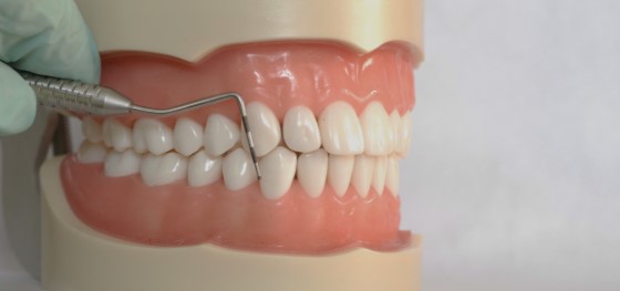 periodontitis treatment