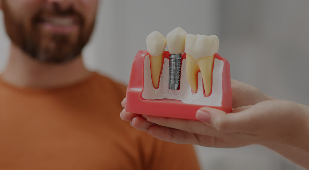 dental implants sydney