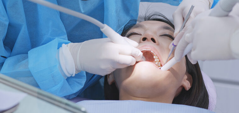 Scaling and Root Planing & Periodontal Debridement