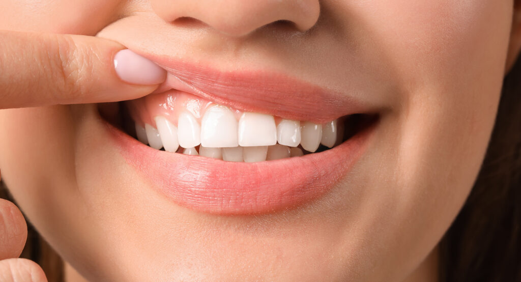 What do healthy gums look like